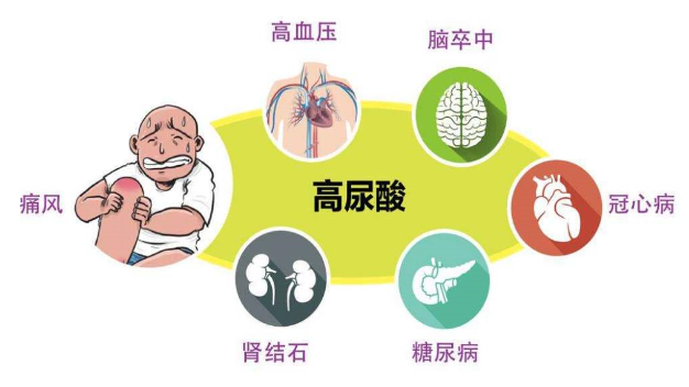 高尿酸与高血脂的关系,看完此文你就知道痛风病人可不可以吃大鱼大肉了!