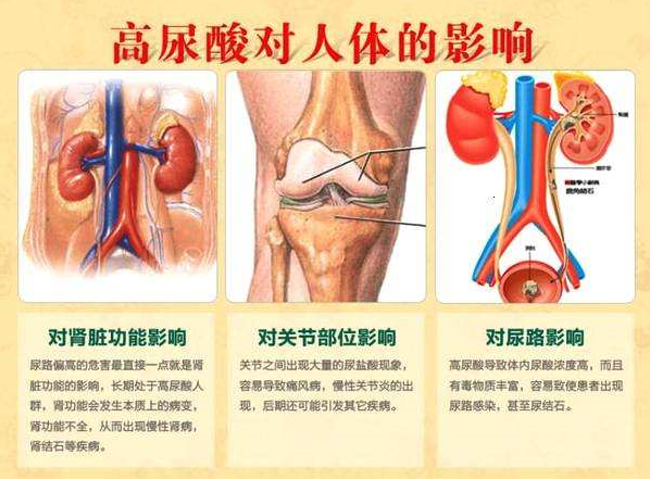 记尿酸对身体的危害.png