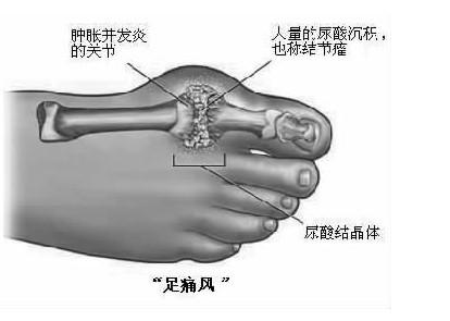 u=3992565108,1343119785&fm=26&gp=0.jpg