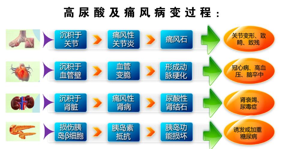 高尿酸如何降？降尿酸常用治疗药物有哪些？