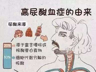 痛风为什么一定要控制尿酸？