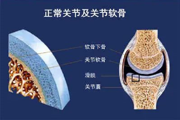 小分子胶原蛋白肽对关节炎效果怎么样，吃多久能治疗好关节炎