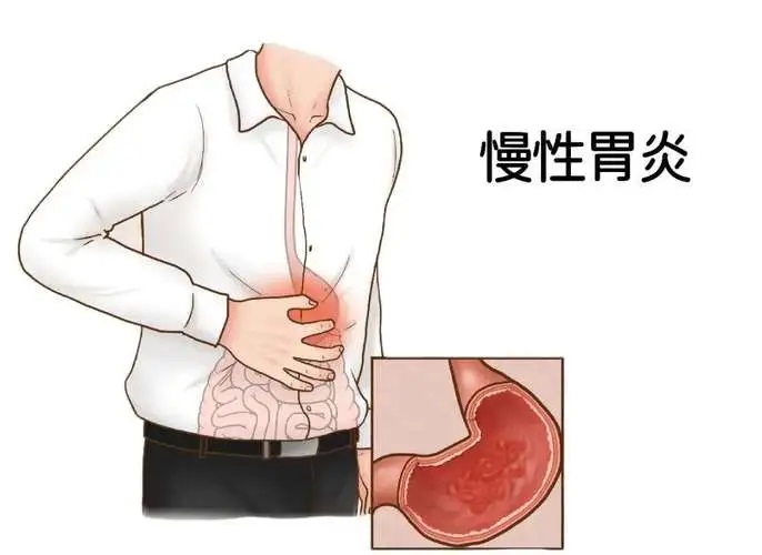 慢性肠胃炎是怎么引起的,慢性肠胃炎怎么调理?