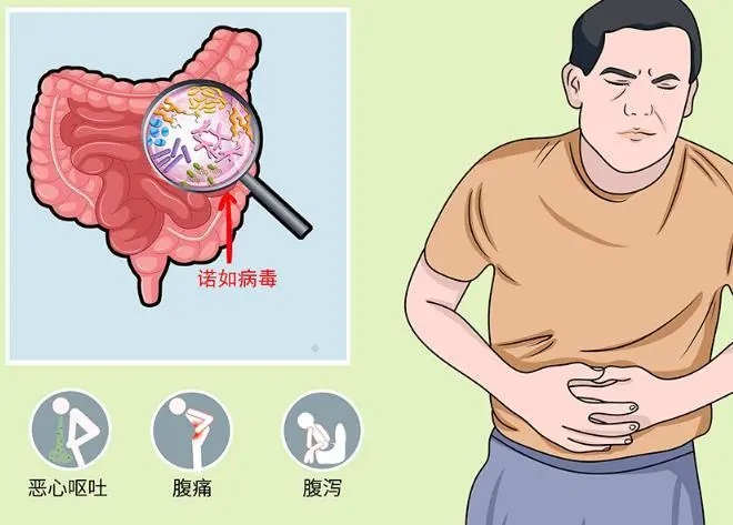 肠胃炎有什么症状,肠胃不好可以吃肽吗？