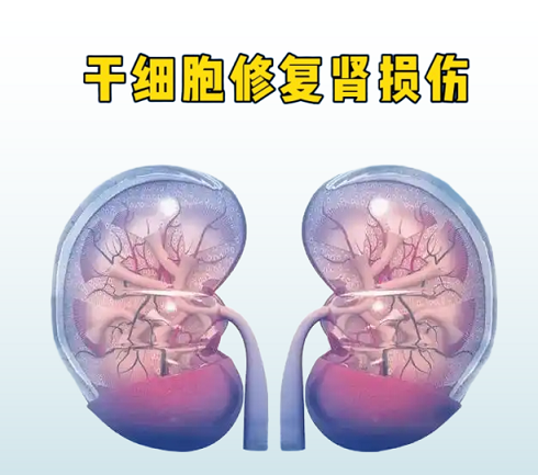 骨髓干细胞对肾部疾病有用吗,骨髓干细胞能再生吗?