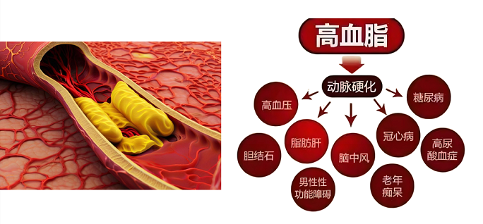 肽调理高血脂效果怎么样,肽能降血脂吗?