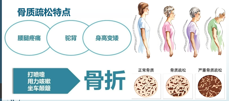 人参牛骨髓肽的功能,人参牛骨髓肽预防中老年人骨质疏松吗？