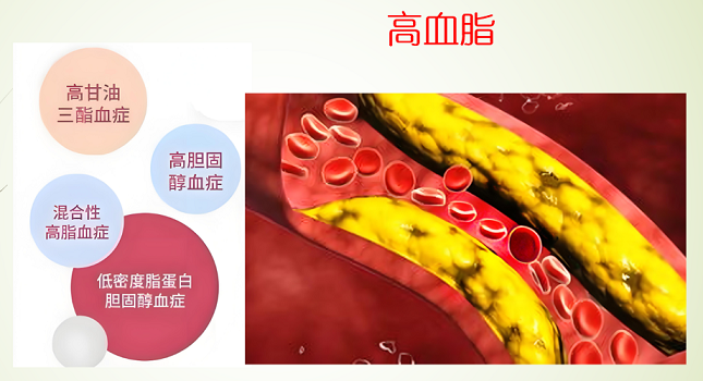血脂高吃纳豆地龙蛋白肽的好处,纳豆地龙蛋白|肽降血脂效果.
